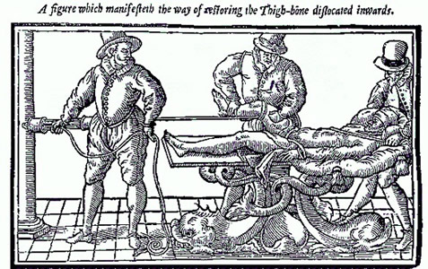 Thigh Luxated Inward with Pulley